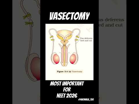 Reproductive Health { Vasectomy} #biology #neet #ncert #shorts #science #trending #viral #vasectomy