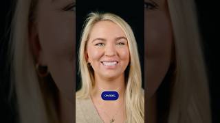 CLEFT PALATE AND LIP SMILE TRANSFORMATION | Smile Texas #cleftlipandpalate #cleftlip #veneers #teeth