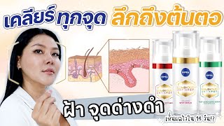 (กูรูเช็ค) NIVEA LUMINOUS 630 เคลียร์ฝ้ากระ จุดด่างดำ รอยดำสิว ลึกถึงต้นตอ เวิร์คจริง!