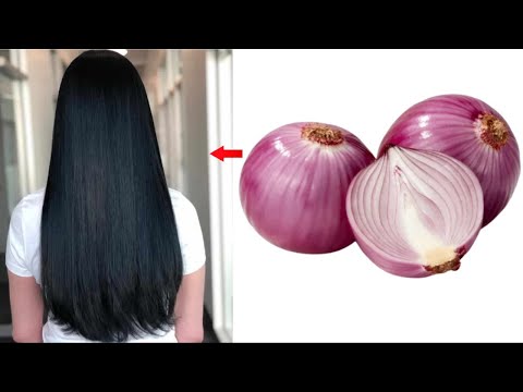 How To Make Onion Hair Oil At Home | How To Make Onion Hair Oil At Home