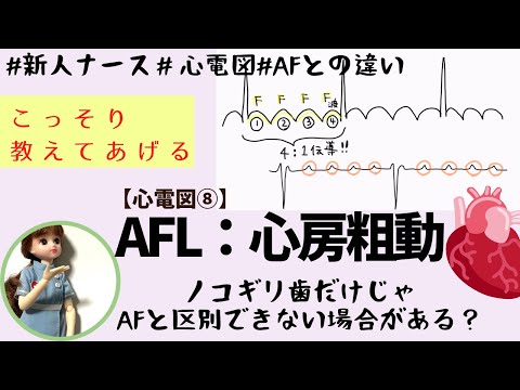 【心電図読み方⑧】心房粗動と心房細動をすっ〜っと理解◎ー#看護師#勉強#新人ナース
