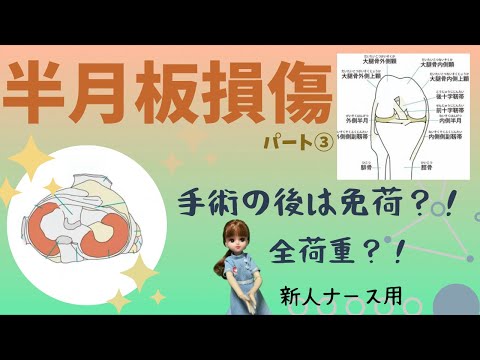 【半月板損傷③】半月板縫合術と切除術のその後の違い#整形外科#看護師#勉強