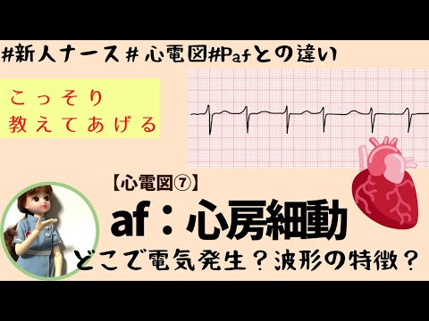 【心電図読み方⑦】af心房細動を読める＆簡単に覚える！Pafとの違いも♪#新人ナース#勉強#循環器