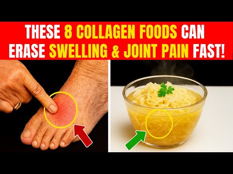 Over 60? These 8 Collagen Foods Can Erase Swelling and Joint Pain FAST