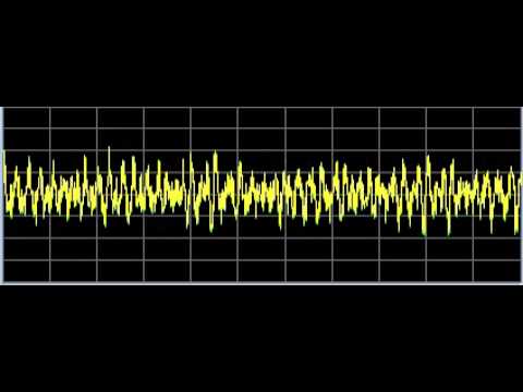 Leukemia 2 - Rife Frequencies