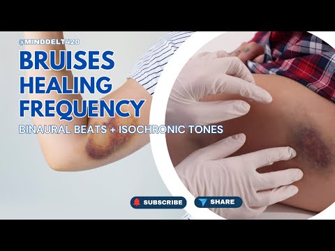 Bruises Rife Frequency Cure | Pure Tone Binaural Beats + Isochronic Tones Healing Sounds