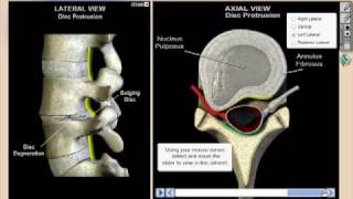 Virtual Consultation for Chiropractic Patient Education