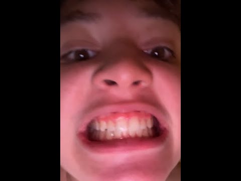 DO NOT WATCH ☠️☠️