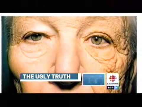 Dr. Carroll Discusses the Ugly Truth about UV Damage