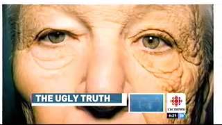 Dr. Carroll Discusses the Ugly Truth about UV Damage