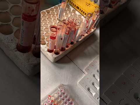 Med student dairies✨ #medicine #doctor #vlog #medicalstudent #study #shorts  #viral #unilife #short