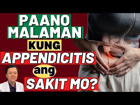 Paano Malaman Kung Appendicitis ang Sakit Mo? - By Doc Willie Ong (Internist and Cardiologist)