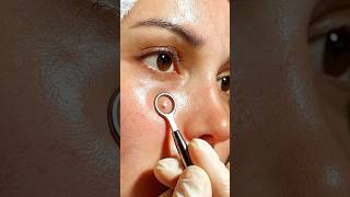 Clear Care #638 | Blackheads Out