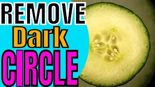 How to Remove Dark Circles 7 | How To Remove Dark Circles Overnight Naturally | #MrFatty