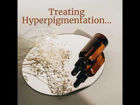 Treating Hyperpigmentation......