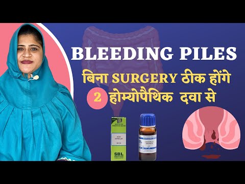 Bleeding Piles Treatment Without Surgery | Piles Treatment | बवासीर की होम्योपैथिक दवा |