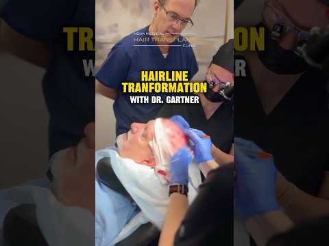 💈✨Dr. Gartner’s Game Plan for the Perfect Hairline / #hairsurgery #hairtransplantfue