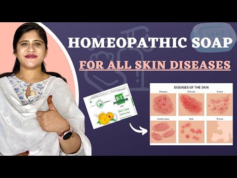 Best Homeopathic Soap : For All Skin Diseases | Bathing soap with Calendula | Dr. Arwa Bohra