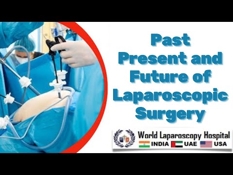 Past Present and Future of Laparoscopic Surgery - Introduction of Minimal Access Surgery