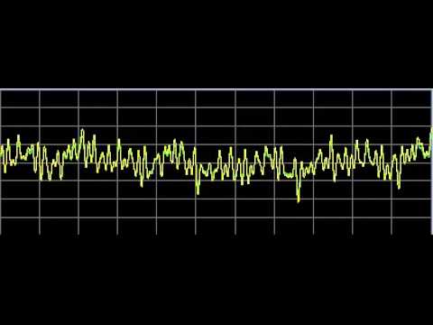 Bone Diseases - Rife Frequencies