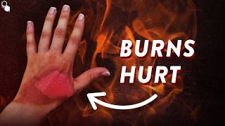Why Do Burns Hurt So Much?