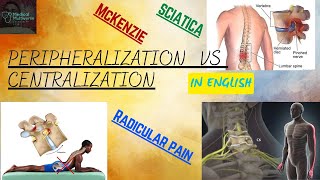 Peripheralization VS Centralization in English | Radicular Pain Symptoms | McKenzie Principle