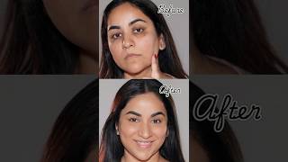 NO Foundation & Concealer: How to Cover Dark Circles, Spots & Scars
