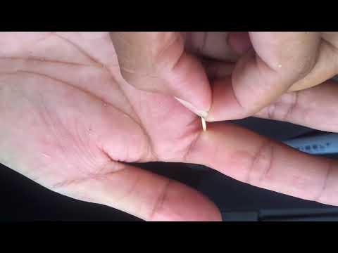 Pulling out a plywood splinter that went through 1 5 fingers