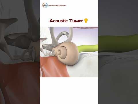 Acoustic Tumor👂 | #shorts