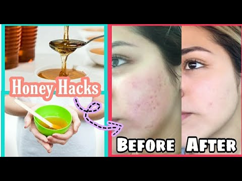 Use honey for clear, healthy and glowing skin | Honey beauty tips | Honey uses for skin || SkyIsReal