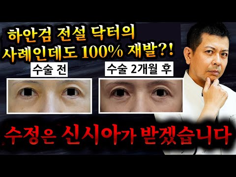 눈밑지방제배치 레전드에 의한 눈밑지방제배치가 재발했다. 게다가 TV출연 의사가 악화 시켰다! 그것을 신시아가 예쁘게 수정하였으니 그 과정을 절처히 해설하겠습니다.