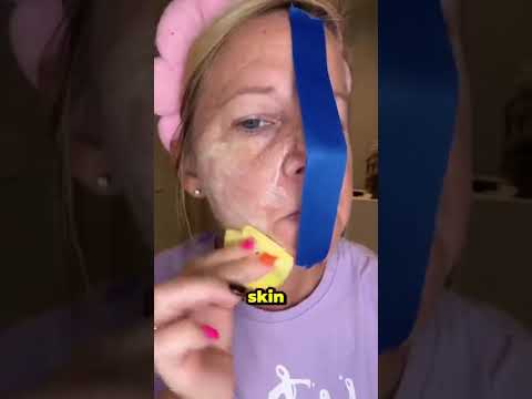 Before & After Using Kojic Acid & Turmeric Pads | Amazing Skin Transformation