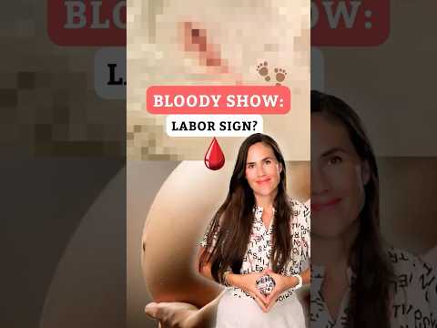 Bloody Show: Is It a Sure Sign of Labor?