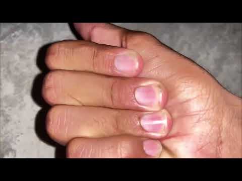 Look friends, what has happened to your hands, they are turning completely red and yellow