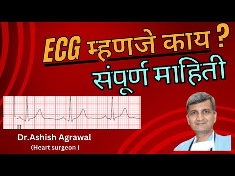 ECG टेस्ट म्हणजे काय व ती टेस्ट का केली जाते ,संपूर्ण माहिती | ECG Test | Electrocardiogram