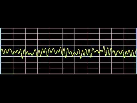 HPV (Human Papilloma Virus) - Rife Frequencies