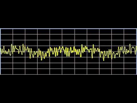 Eyelid Droop (Ptosis) - Rife Frequencies