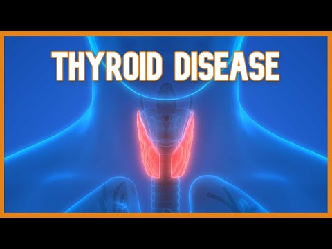 Thyroid Disease (Hyperthyroidism vs. Hypothyroidism)