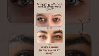 “The BEST Natural Remedy for Dark Circles 👁🌿” #purealchemy #skincareroutine #fatburningsecrets