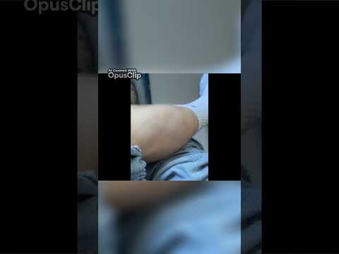 Dog's Hilarious Reaction to the Ultimate Leg Cramp