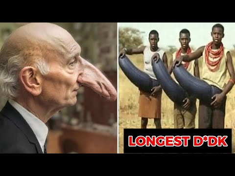 Top 25 People With Bigger Than Normal Body Parts