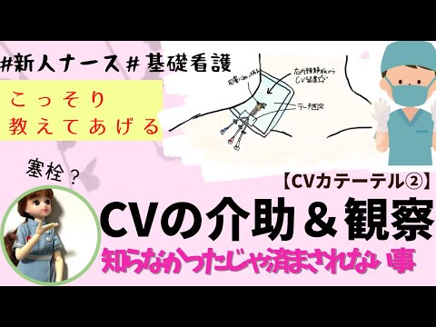 【基礎看護】CV介助＆観察！知らなかったじゃ済まされない事もある。#看護師#勉強