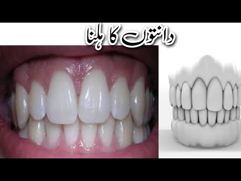 دانتوں کا ہلنا  || Health tips Home