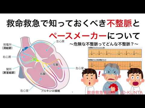 救命救急で知っておくべき不整脈とペースメーカーについて