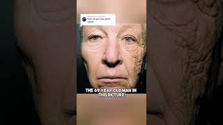 How Quickly the Skin Ages Due to Sun Exposure