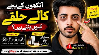 Dark Circles Kyun Hote Hain? | Complete Guide, Causes, Treatment & Best Products (Urdu)