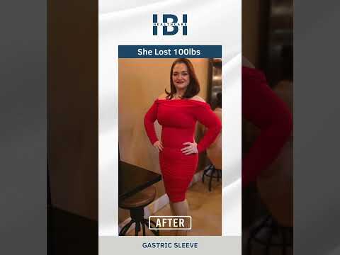 Ms. Blanca’s journey with the gastric sleeve