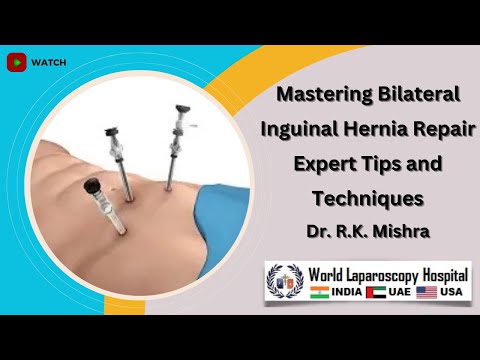 Mastering Bilateral Inguinal Hernia Repair:  Tips and Techniques from World Laparoscopy Hospital