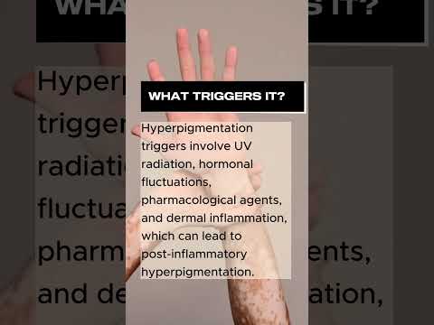 The Ultimate Guide to #Hyperpigmentation