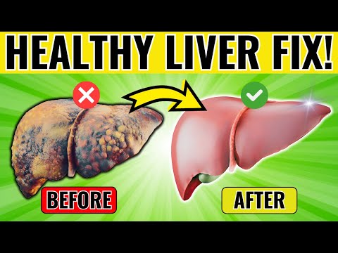 A NEW LIVER IN 30 DAYS?! 8 Ways To REVERSE Fatty Liver Disease!